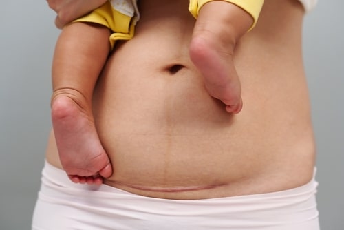 Cook County, IL birth injury lawyer